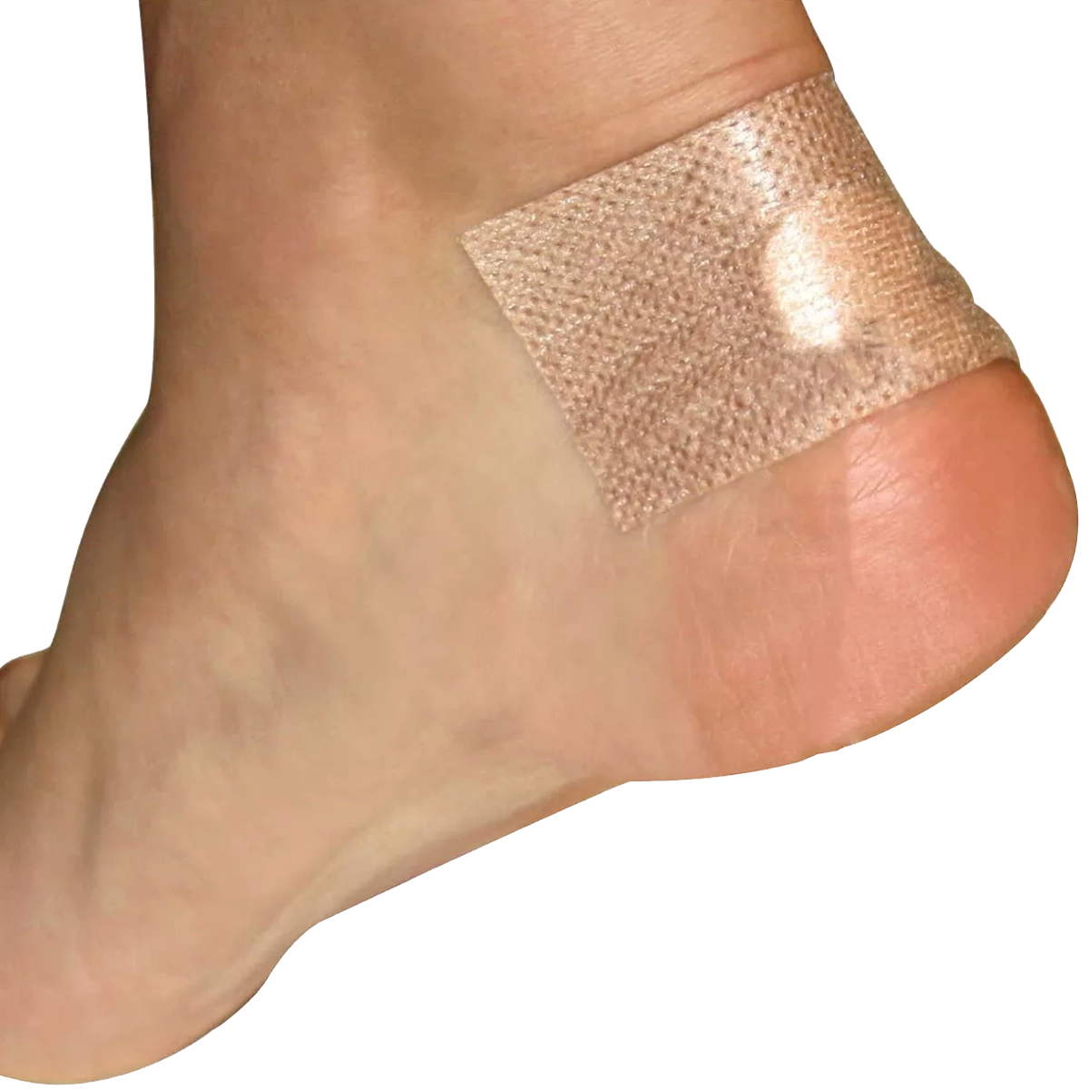 2nd Skin Sports Blister Kit